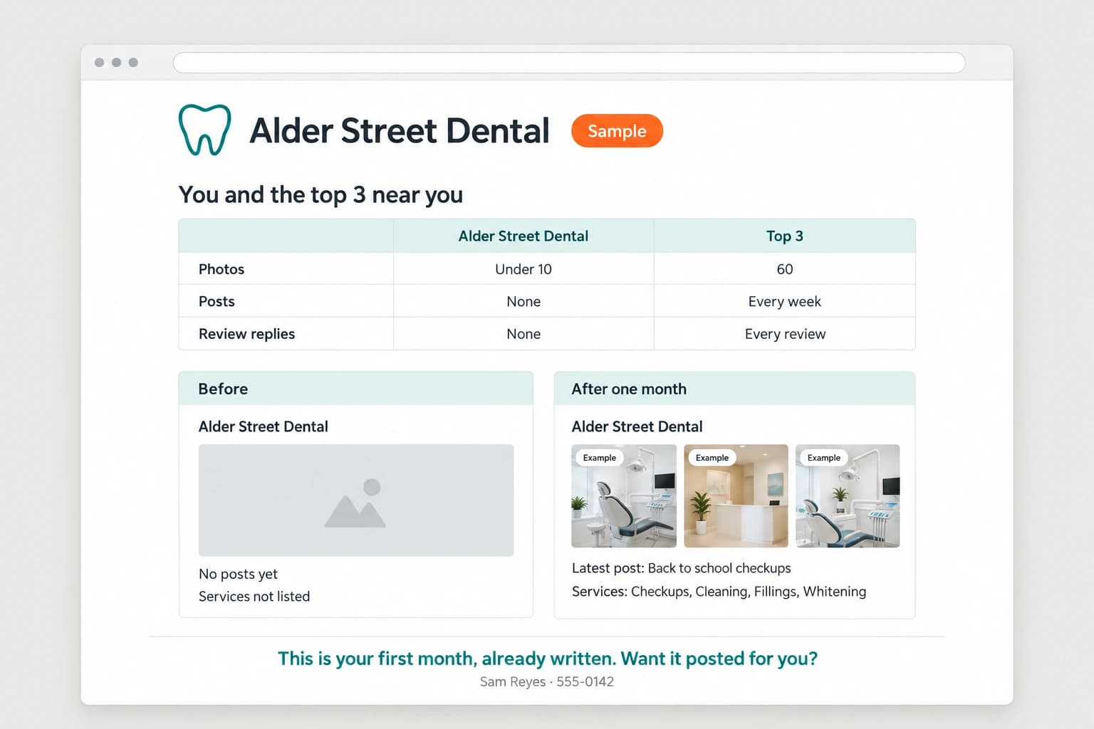 A demo page for Alder Street Dental tagged Sample. At the top, a table of their photos, posts and review replies next to the top 3. Below, a Before card with no photos, no posts and no services listed, next to an After one month card with photos tagged Example, a latest post and a services list. At the bottom, This is your first month, already written. Want it posted for you?, with a name and number